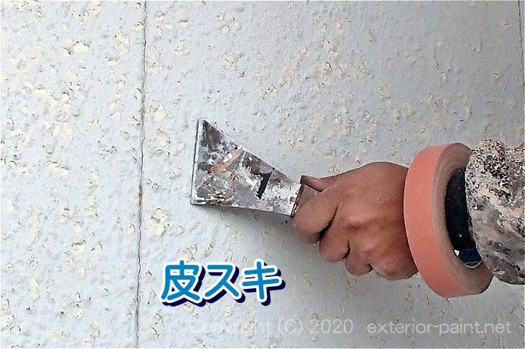 皮スキ
